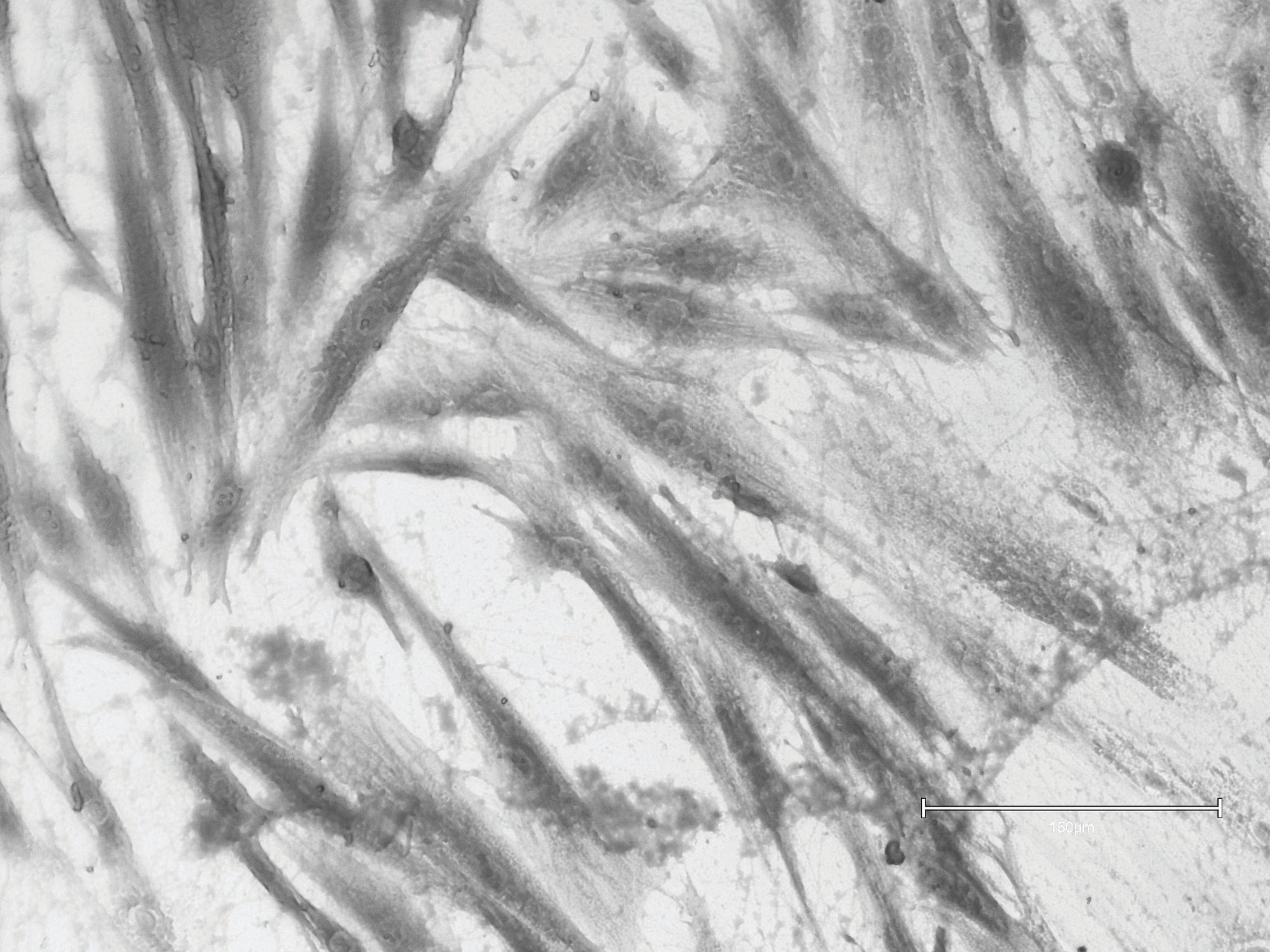 No Treatment (Control)